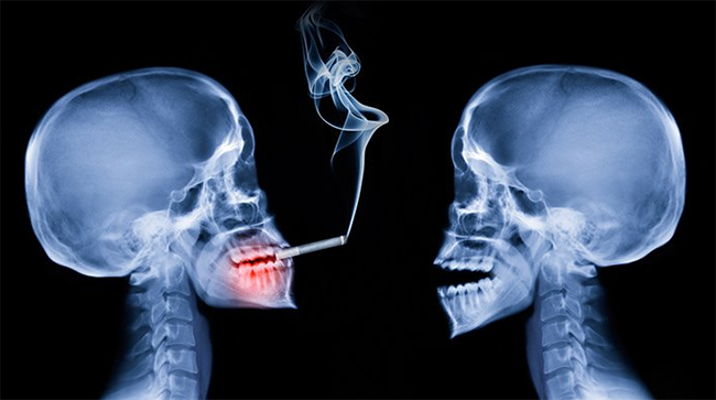 "Пассивное курение" и вэйпинг. Общество часто сопоставляет эти два понятия. Разберемся раз и навсегда...